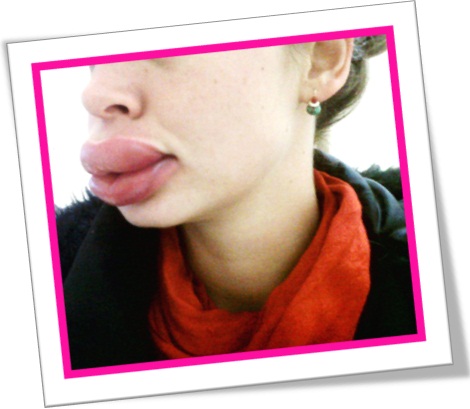 swollen lips, mulher, lábios inchados, boca grande, lábios carnudos